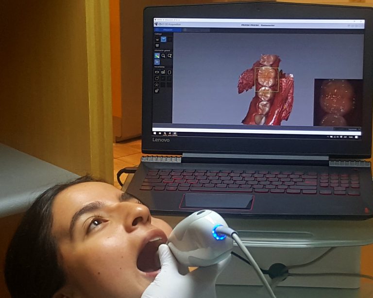 CAD/CAM: Evolucionamos el Tratamiento Dental en Clínica Gil Costa Rica