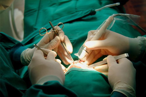 Fotografía muestra unicamente las manos que están realizando una cirugía oral Maxilofacial