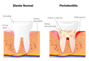imagen periodoncia 